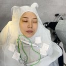 눈밑지방재배치 수술 후 부작용 삼백안 리얼 후기