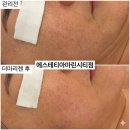 Brush | 해운대피부관리, 에스테티아 마린시티점 솔직 후기