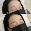 리메이드배곧점