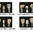 예스덴탈 이미지