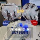 서구-02-98 | [인천] 청라두피케어 &#39;웰킨 청라점&#39;에서 정밀검사와 파워스케일링 받아본 상세 후기(비포애프터⭕️)