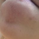 레드필 | 더마팩토리 레드 아크네 필 내돈내산 사용후기