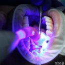 청담치과의원 네이버블로그