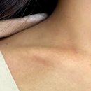 동아유통 - 군산시 백릉로 10 | 동아제약 디판테놀 연고 가격(D판테놀 크림), 피부염 사용후기