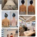 연제구-109 | 부산 연제구 피부관리 전문샵 피부에 밥주는날 재방문 후기 연산동피부관리 L자어깨만들기