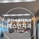 예스안치과의원 네이버블로그