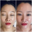 JS스킨케어 - 사천시 | [사천 디바스킨] 예비 신부 입소문 찐후기! 멍 걱정 없는 웨딩관리 '디데이 케어'