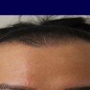 모앤블레스의원 이미지