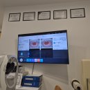 경산안경점 | 경산안경점 정밀 검안 서비스 가성비 맞춤 안경 후기 : ICU비전케어 위드렌즈 경산점