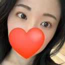 팝성형외과 | 팝 성형외과 눈재수술 후기 4편-4개월차