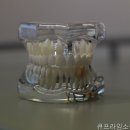 큐프라임부천치과의원 네이버블로그