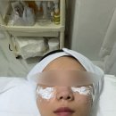 윤블리 네일샵 | 인천 멜라즈마 동암 피부관리 주근깨 관리는 윤블리네일에서 함께