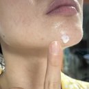 나무약국 | 약국 좁쌀여드름 연고 내돈내산 아이템 후기