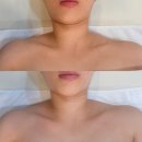 더푸르개 | * 광주 서구 풍암동 에스테틱 : 포미뷰티 윤곽관리 후기 - 시원하게 풀어주고 관리후엔 효과 좋아요