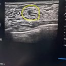 유앤장내과의원 | 상봉 유앤장내과 유방초음파 엑스레이 통증 조직검사 결과 : 섬유선종 두둥😭