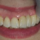 거성치과기공소 이미지