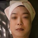 아산피부관리 필수! 용화동 브니엘 에스테틱 VITA DX로 피부 리뉴얼