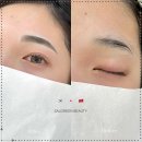 그린브로우