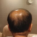 스킨 앤 바디 신의손 | 서울 두피관리 스킨앤바디신의손에 다녀온 솔직 후기
