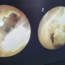 굿모닝보청기 이천센터 이미지