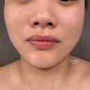 약손명가구리점 균형얼굴관리 작은얼굴 후기