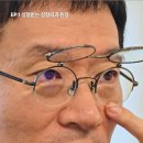 더올림성형외과의원 네이버블로그