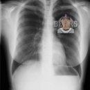 홈런 코리아 이미지