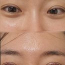 새마을달서구지회 앞 | 계명대속눈썹 유오뷰티 수분가득펌 후기