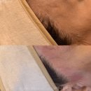 유니헤어보톡스 네이버블로그