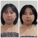 쏘영피부연구소 네이버블로그