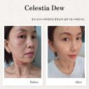 서면피부관리샵 아렌스킨 K-Beauty 연예인 관리 후기 내돈내산