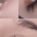 하이얀피부 이미지
