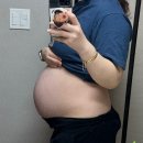 (주)이지메디컴 100세동안 | [35주]35주차 일상 / 소화불량 / 허리통증 / 붓기 / 출산휴가 마지막 출근