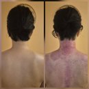 원도안로-29 | 대전도안피부관리 아인뷰티 얼굴소멸관리 받고 천프로 만족한 후기