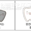 임플라인치과 이미지
