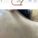 [후기] 드루카니카는 재생능력도 뛰어나지만 어혈에도 당연좋아요!