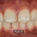 다이아스 이미지