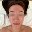 울산 언양 피부 진정 고보습 CIACLAR 바셀 트리트먼트 관리 에스테틱 추천 - ‘나다움 에스테틱’ -
