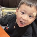 365열린약국 | 고성에서 아이 이마가 찢어졌다면? 서울 상처봉합 365일, 24시 응급성형외과♥ 8바늘 꼬맨 3살!! 열상...