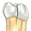 이(e)-밝은치과의원 이미지