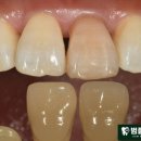 범플란트치과의원 이미지