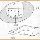 갑자기 이빨이 아플때 이미지