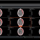 코어소프트 이미지