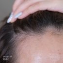 빠기샵 | 여자 임산부 M자 탈모 고민? 리필드 cADPR 부스터프로 두피홈케어 추천