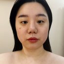 이마상사김포지점 | 김포 피부관리 추천│이연에스테틱 올리지업 2000샷 후 느낀 리프팅 효과