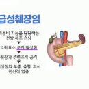 왼쪽 옆구리 통증 유발하는 원인 이미지