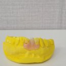 다윗치과기공소 이미지