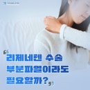텐 프로 | 리제네텐 수술 부분파열이라도 필요할까? 서울 강남 어깨병원