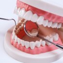 호계치과의원 | 호계치과, 후기로는 절대 알 수 없는 2가지