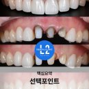 네이치과기공소 이미지